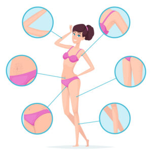 Woman depilation. Female body hair removal armpits and waxing vector cartoon infographics. Illustration depilation skin, perfect skincare and clear